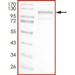 EGFR (d747-749), Active with mCherry